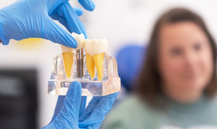 Dentist demonstrating a dental implant model